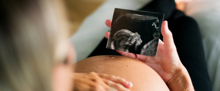 Person holding ultrasound image next to their pregnant belly.